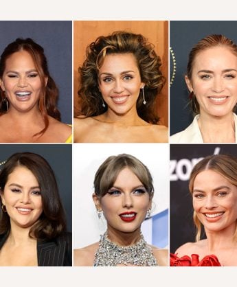 celebrity veneers