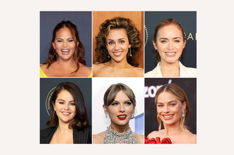 celebrity veneers